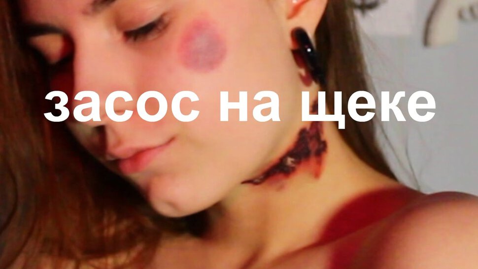 Как поставить засосы на шее самому
